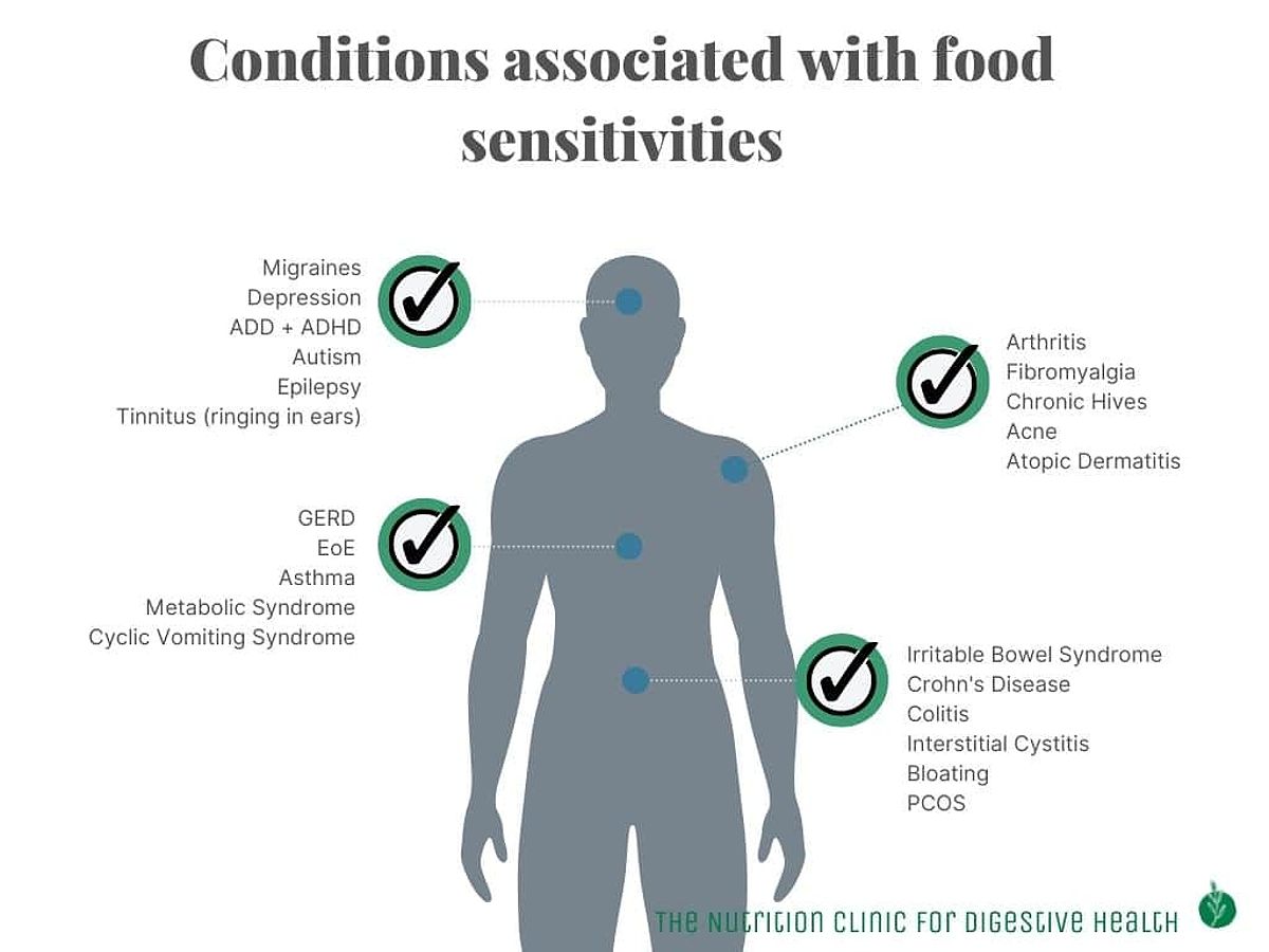 Conditions associated with food sensitivities