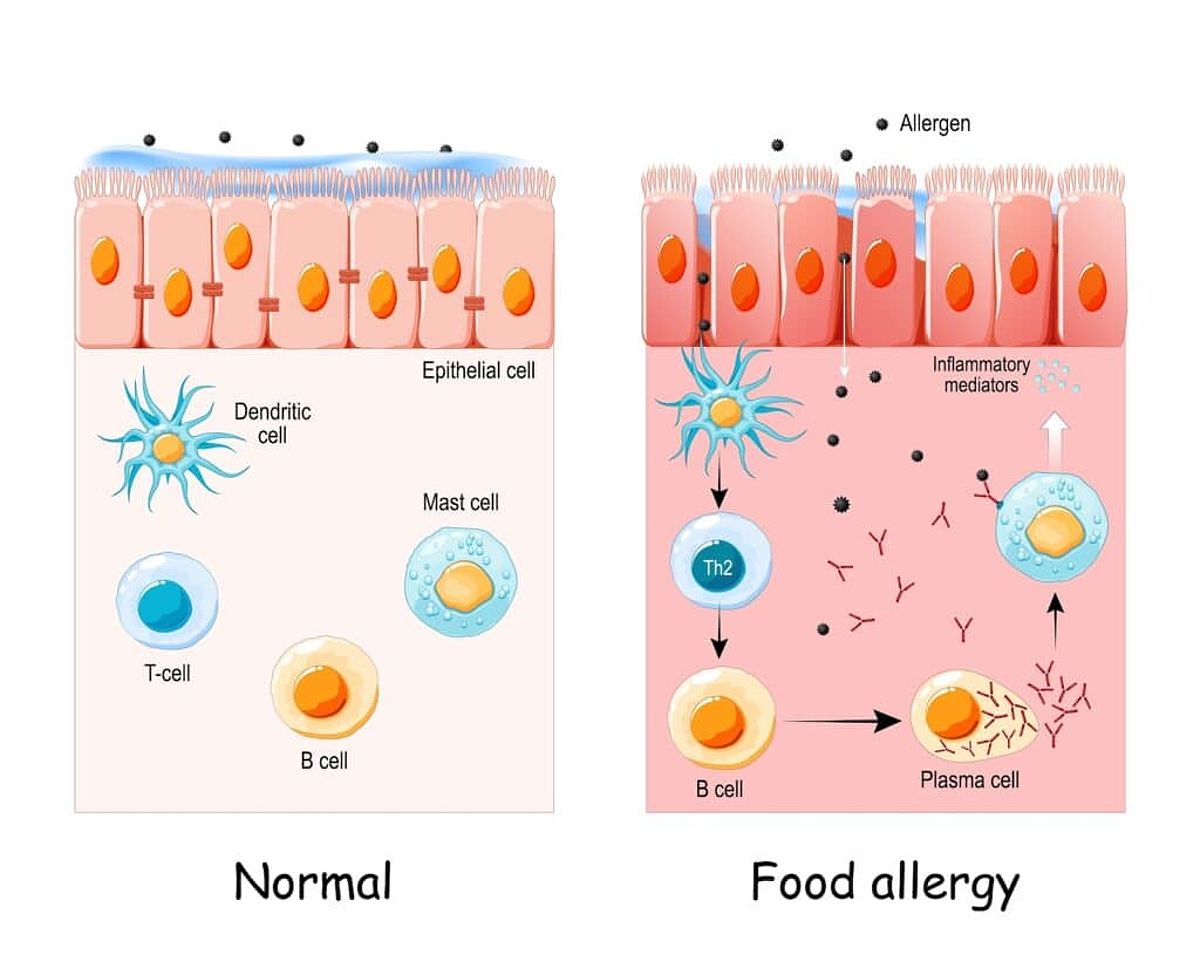 Food allergy immune response