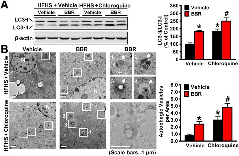 Inflammatory Cytokines