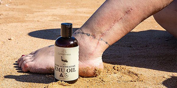 Lady with scar on leg sitting at beach